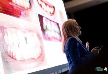 Revolutia zambetului: De ce toata lumea vorbeste despre aparatul dentar Invisalign?